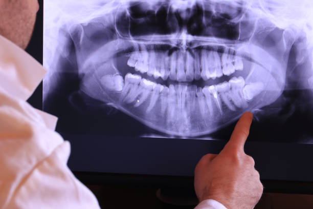 Best Emergency Tooth Extraction in Salina, OK