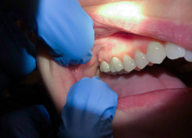 Best After-Hours Dental Trauma Care in Salina, OK