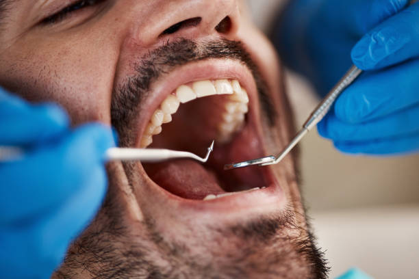 Best Emergency Root Canal Treatment in Salina, OK